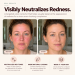 Before and after showing the appearance of facial redness before and after applying Omiana Redness Concealer Cream.